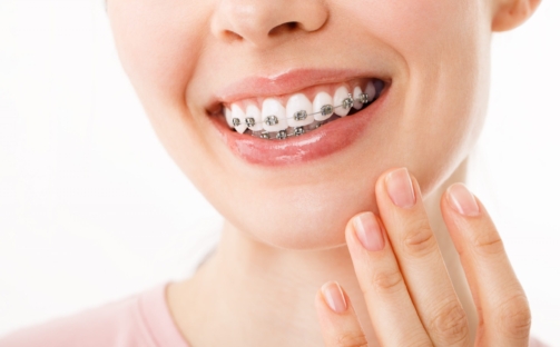 sonrisa salud encias belleza