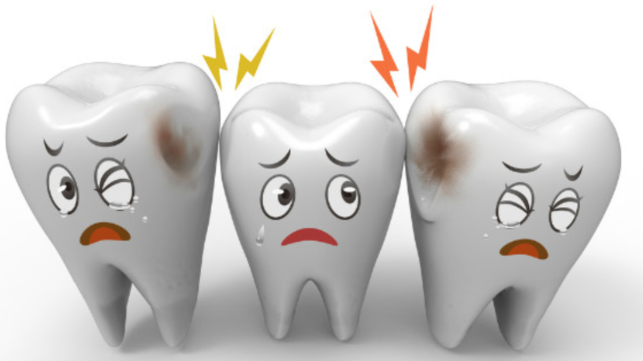 RICHSA_prevenir_caries_prevención