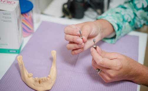 injerto óseo dental cirugía de regeneración zirconio monolítico planificación digital de implantes estética en rehabilitación oral