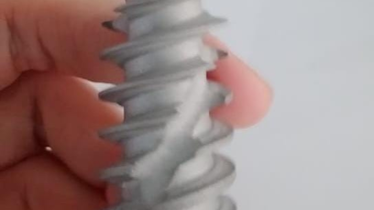 implantes inmediatos, implantología moderna, colocación inmediata, extracción e implante el mismo día, integración ósea, cirugía de implantes, corona provisional, planificación digital, estabilidad primaria, estética dental, rehabilitación con implantes, injerto de encía, osteointegración, implantología estética, éxito de implantes, dientes anteriores, colocación postextracción, tratamiento dental avanzado, implantología guiada, salud oral.