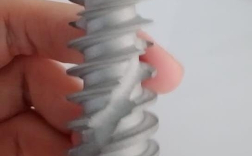 implantes inmediatos, implantología moderna, colocación inmediata, extracción e implante el mismo día, integración ósea, cirugía de implantes, corona provisional, planificación digital, estabilidad primaria, estética dental, rehabilitación con implantes, injerto de encía, osteointegración, implantología estética, éxito de implantes, dientes anteriores, colocación postextracción, tratamiento dental avanzado, implantología guiada, salud oral.