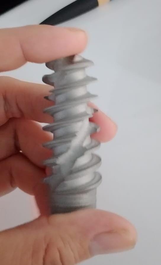 implantes inmediatos, implantología moderna, colocación inmediata, extracción e implante el mismo día, integración ósea, cirugía de implantes, corona provisional, planificación digital, estabilidad primaria, estética dental, rehabilitación con implantes, injerto de encía, osteointegración, implantología estética, éxito de implantes, dientes anteriores, colocación postextracción, tratamiento dental avanzado, implantología guiada, salud oral.